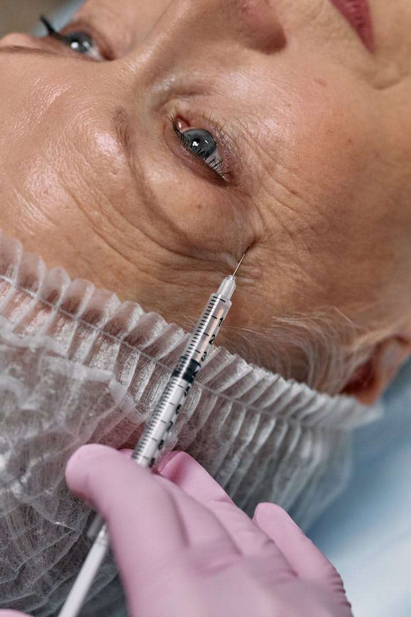Botox Injection Treatment