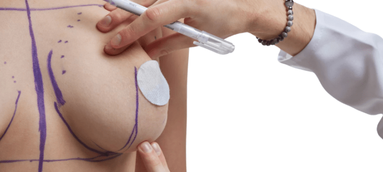Breast Augmentation and Lift in Turkey