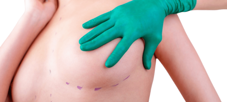 Breast Implant Replacement in Turkey