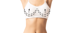 Breast Asymmetry Correction in Turkey